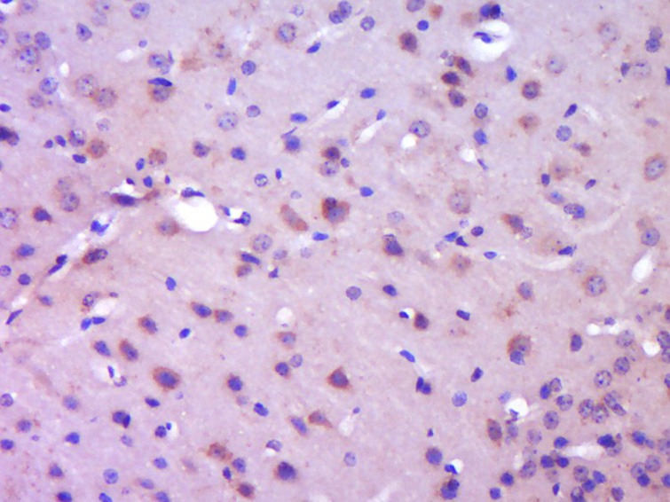 Anti-Phospho-IkB alpha/NFKBIA (Tyr42) Polyclonal Antibody