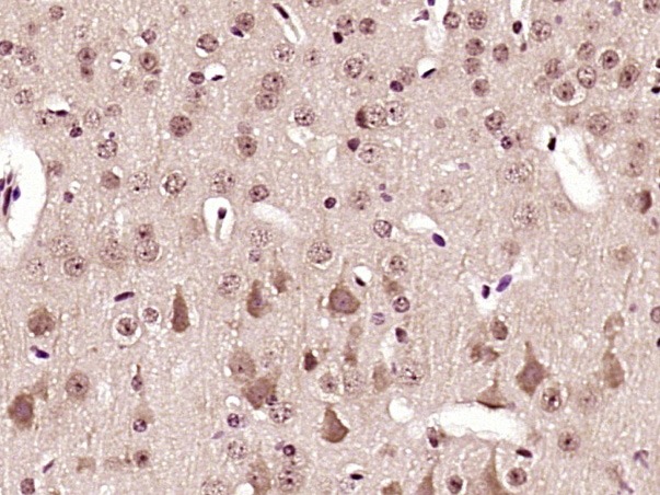 Anti-Phospho-AMPK alpha 2 (Thr172) Polyclonal Antibody