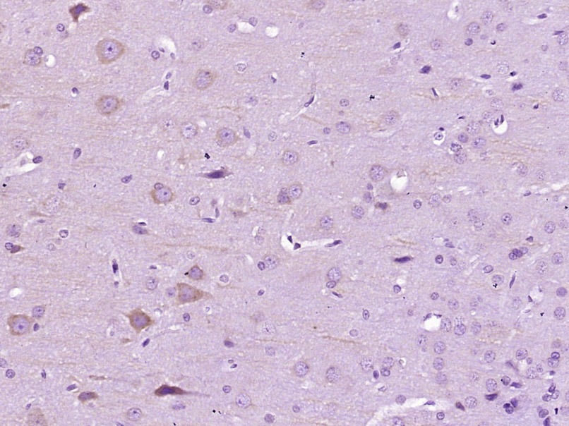 Anti-MAP2 Polyclonal Antibody