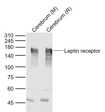 Anti-Leptin Receptor Polyclonal Antibody 2