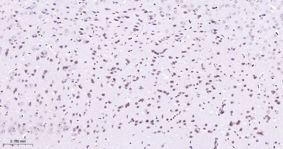 Anti-MAPK14 Polyclonal Antibody 2
