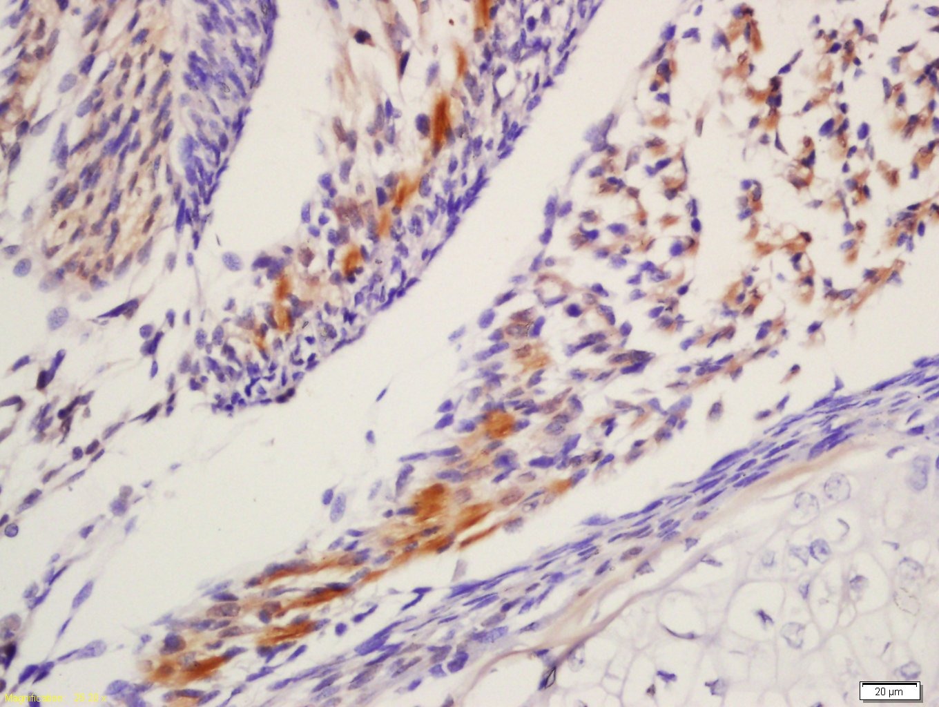 Anti-Leptin Receptor Polyclonal Antibody 2