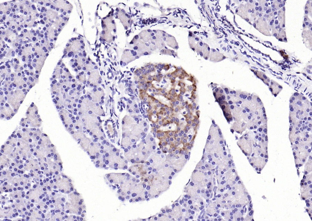 Anti-LGR-5 Polyclonal Antibody 2