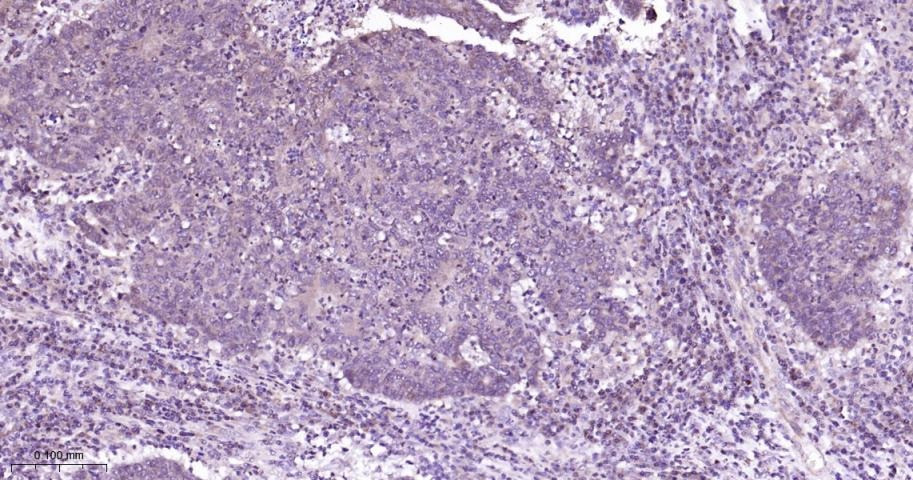 Anti-MAPK14 Polyclonal Antibody 2