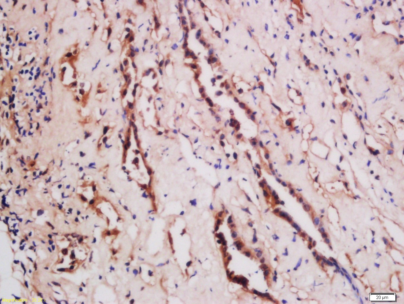 Anti-TL1A/TNFSF15 Polyclonal Antibody