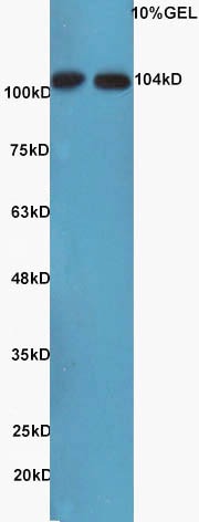 Anti-MAP3K14 Polyclonal Antibody