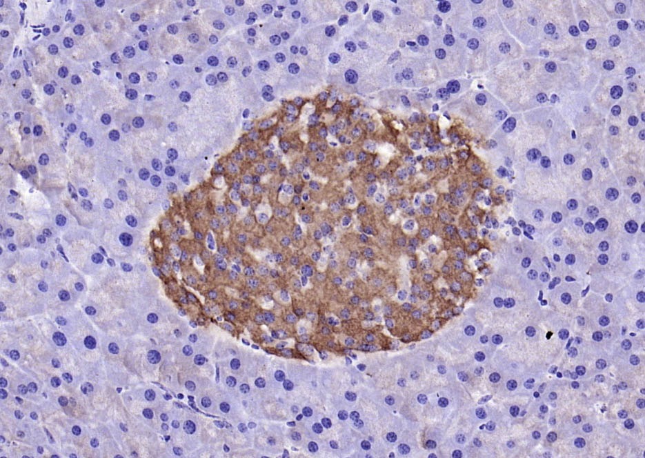 Anti-LGR-5 Polyclonal Antibody 2