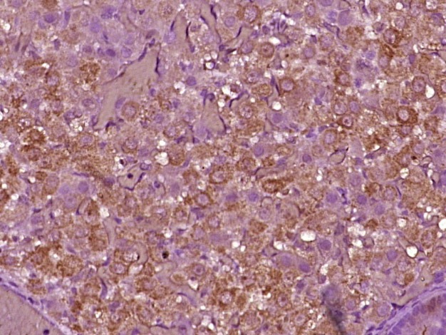 Anti-LHCGR Polyclonal Antibody