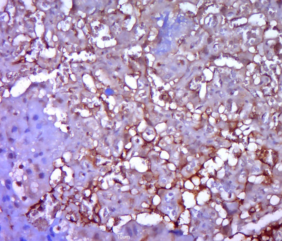 Anti-LGR-5 Polyclonal Antibody 3