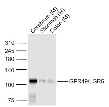 Anti-LGR-5 Polyclonal Antibody 3