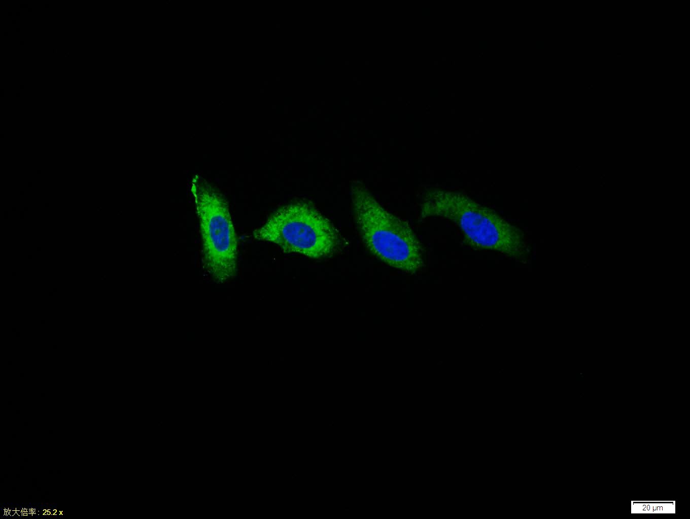 Anti-LDLR Polyclonal Antibody