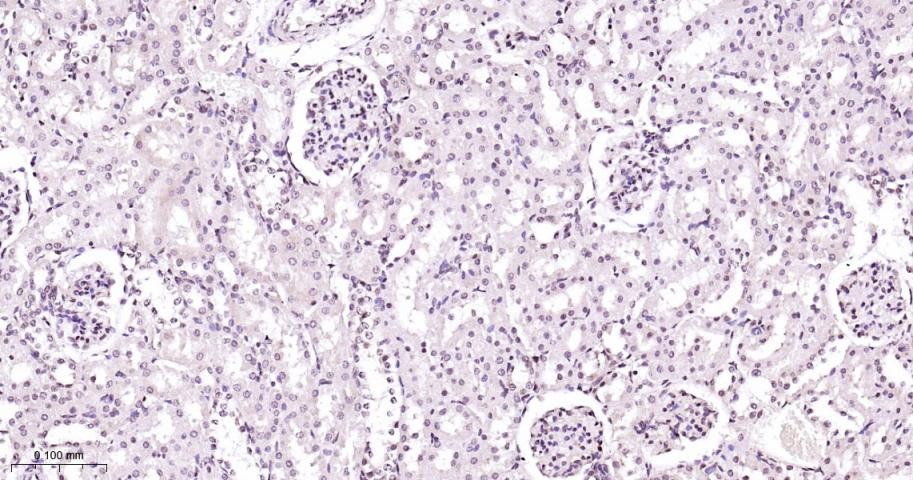 Anti-MAPK14 Polyclonal Antibody 2
