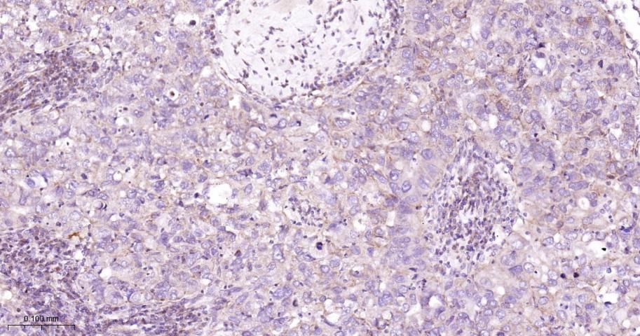 Anti-MAPK14 Polyclonal Antibody 2