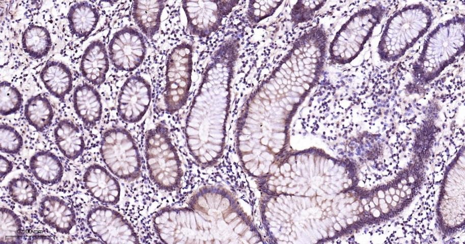 Anti-MAPK14 Polyclonal Antibody 2