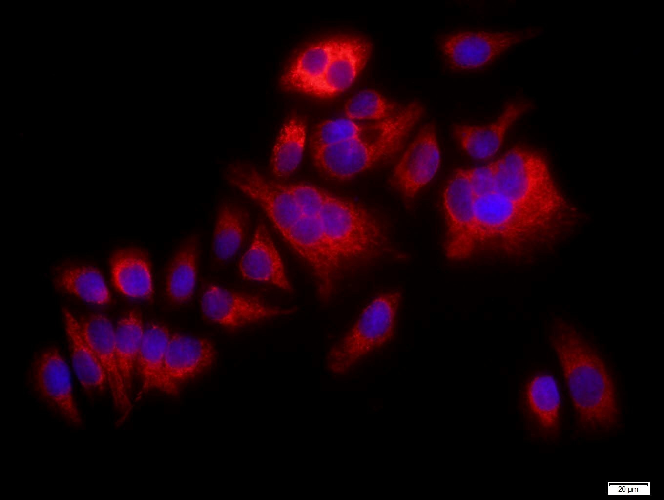 Anti-MAPK14 Polyclonal Antibody