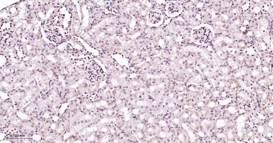 Anti-MAPK14 Polyclonal Antibody 2
