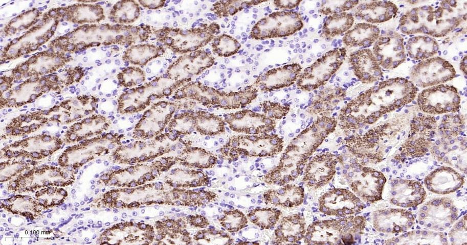 Anti-P Glycoprotein Antibody (1U603)