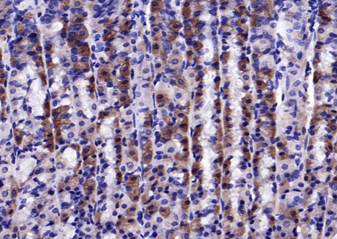Anti-Phospho-CaMKII (Thr287) Polyclonal Antibody