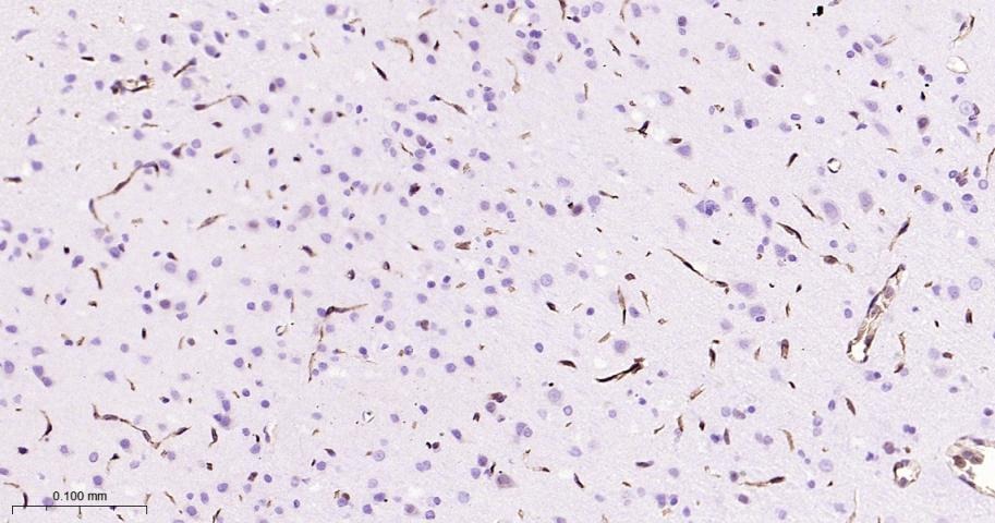 Anti-P Glycoprotein Antibody (1U603)