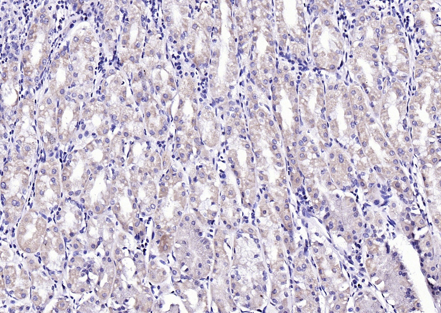 Anti-Phospho-CaMK2 alpha (Tyr230) Polyclonal Antibody