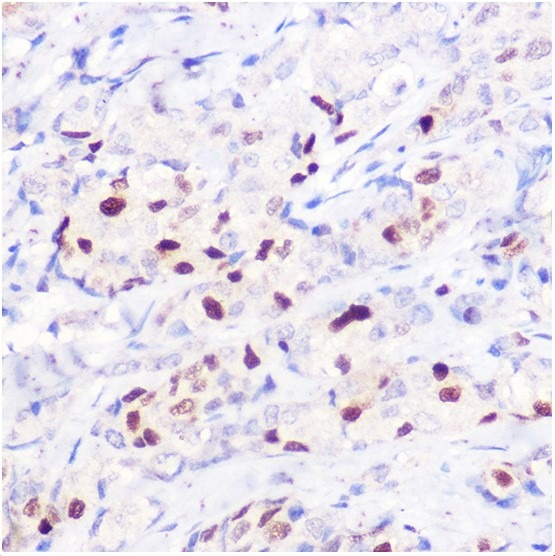 Anti-p21 Polyclonal Antibody