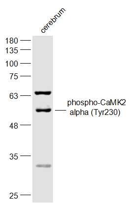 Anti-Phospho-CaMK2 alpha (Tyr230) Polyclonal Antibody
