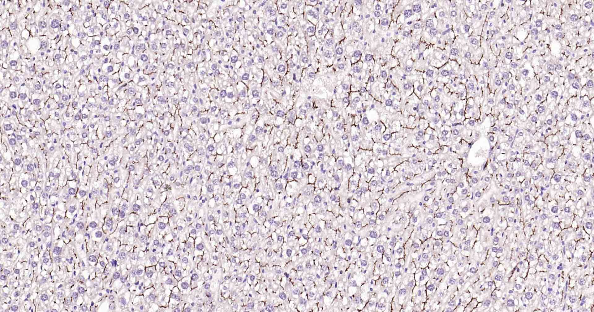 Anti-P Glycoprotein Antibody (1U603)