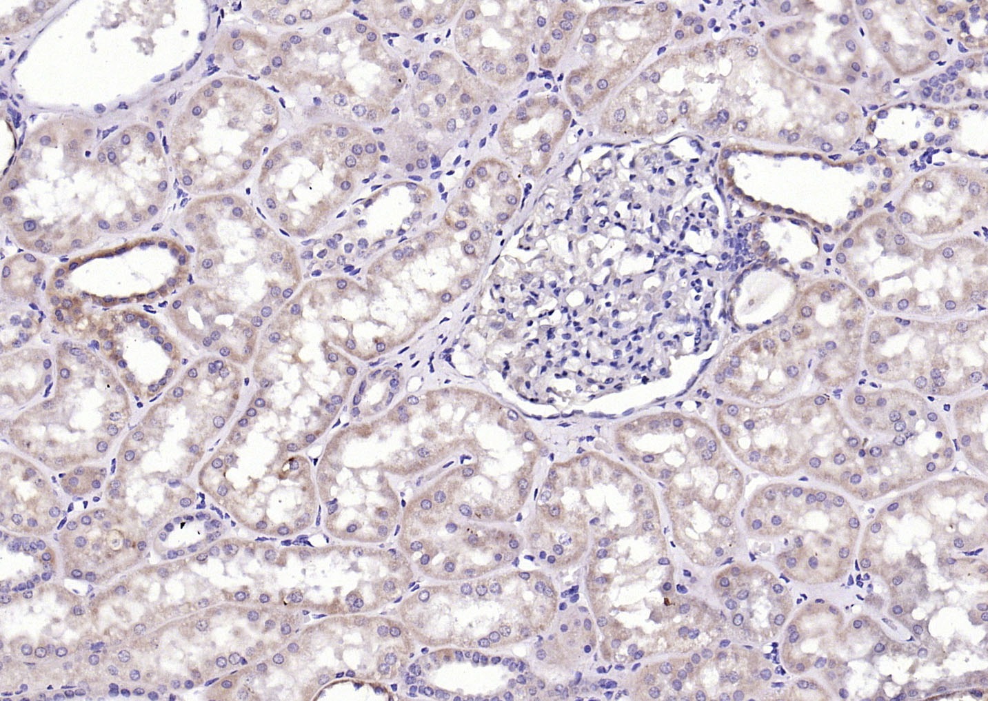 Anti-Phospho-CaMKII (Thr287) Polyclonal Antibody