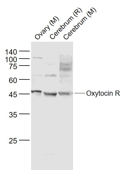 Anti-Oxytocin R Polyclonal Antibody