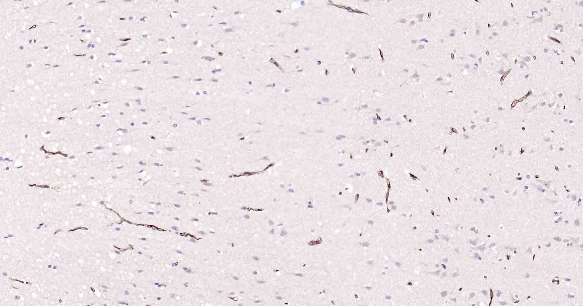 Anti-P Glycoprotein Antibody (1U603)