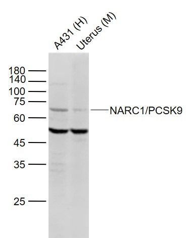Anti-PCSK9 Polyclonal Antibody