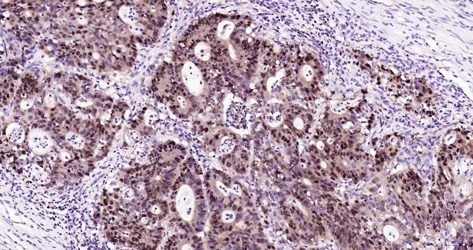 PCNA Nuclear Loading Control Polyclonal Antibody