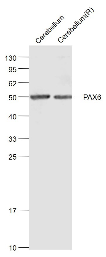 Anti-PAX6 Polyclonal Antibody