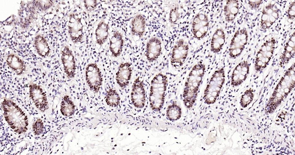 Anti-PCNA Polyclonal Antibody 2