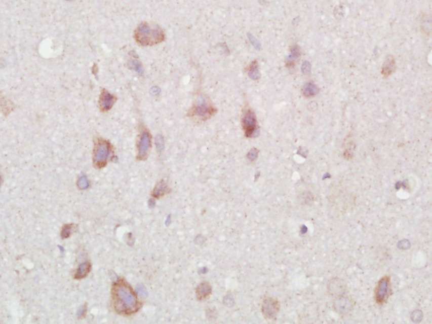 Anti-PCSK9 Polyclonal Antibody