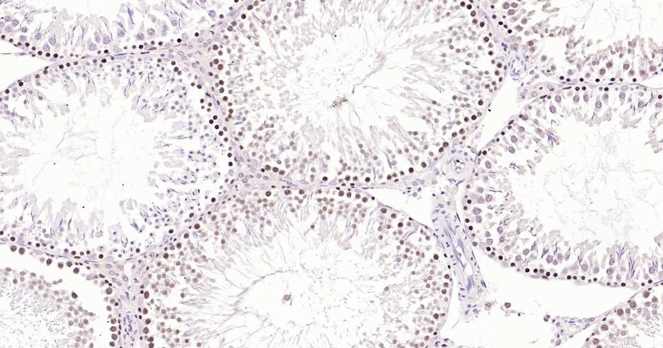 Anti-PCNA Polyclonal Antibody 2