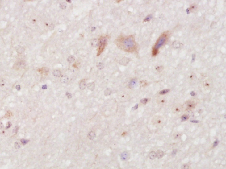 Anti-PCSK9 Polyclonal Antibody