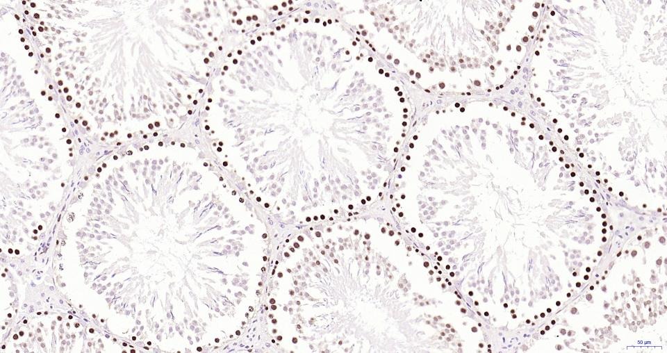 PCNA Nuclear Loading Control Polyclonal Antibody