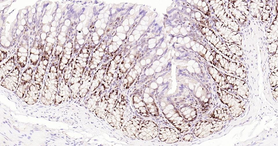 Anti-PCNA Polyclonal Antibody 2