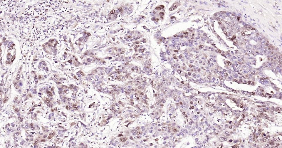 Anti-PCNA Polyclonal Antibody 2