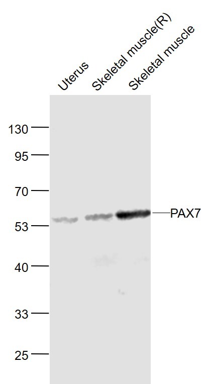 Anti-PAX7 Polyclonal Antibody 2