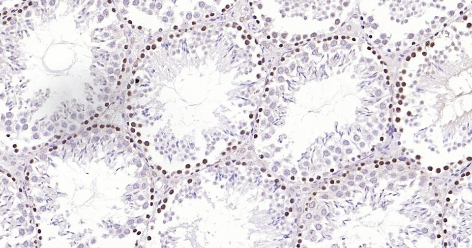 Anti-PCNA Polyclonal Antibody 2