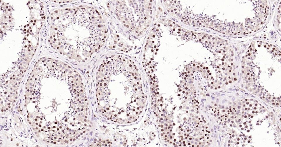 Anti-PCNA Polyclonal Antibody 2