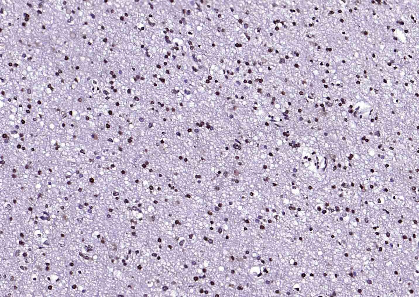 Anti-S100B Polyclonal Antibody