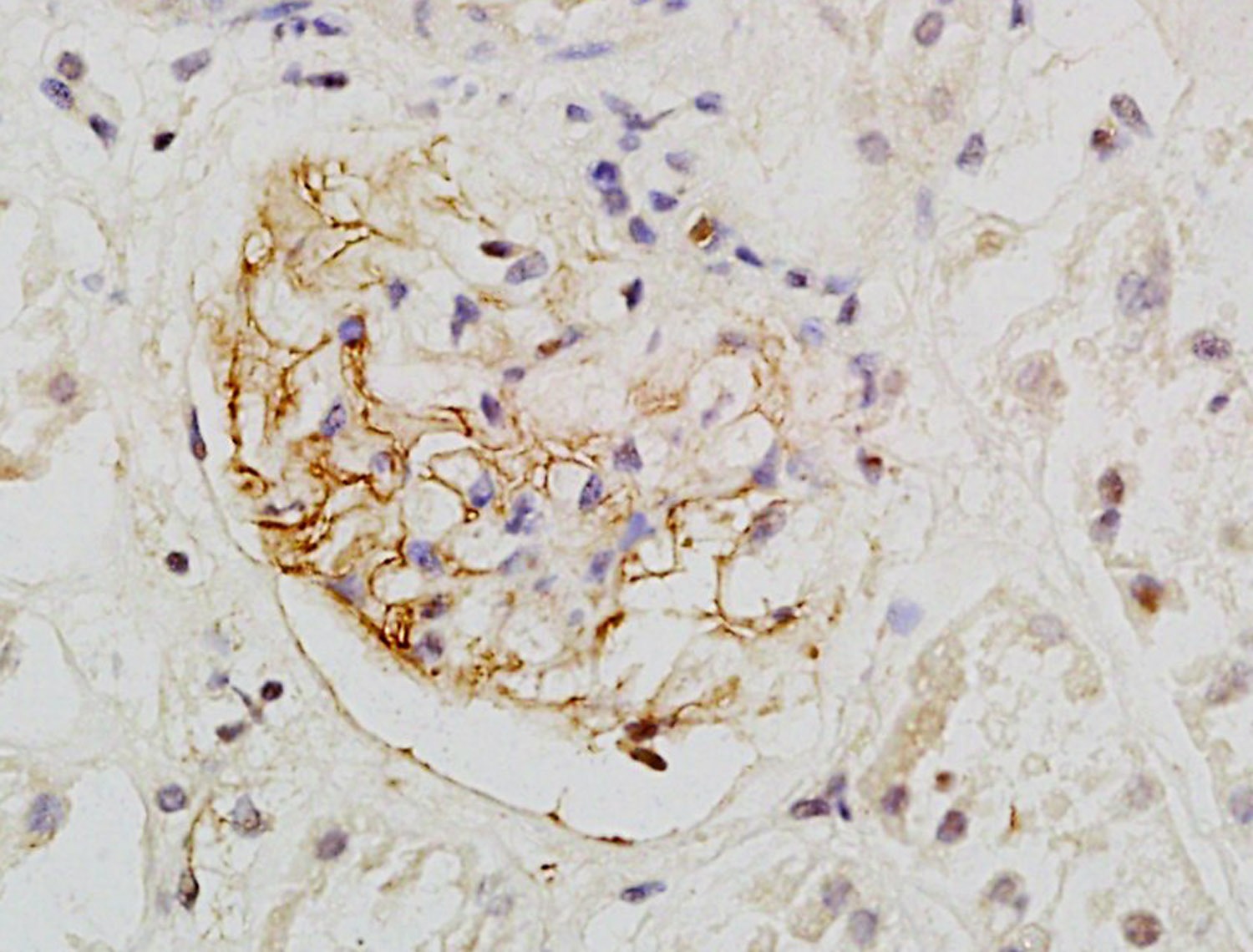 Anti-PODXL Polyclonal Antibody