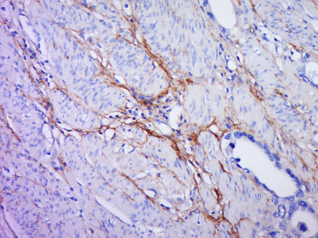 Anti-PLGF/PGF Polyclonal Antibody
