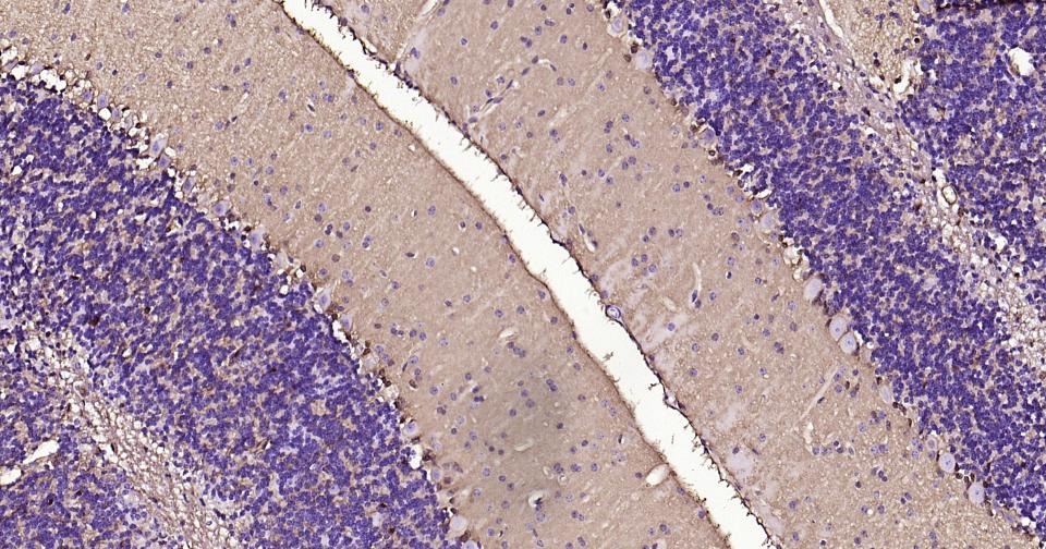 Anti-S100B Antibody (2F740)