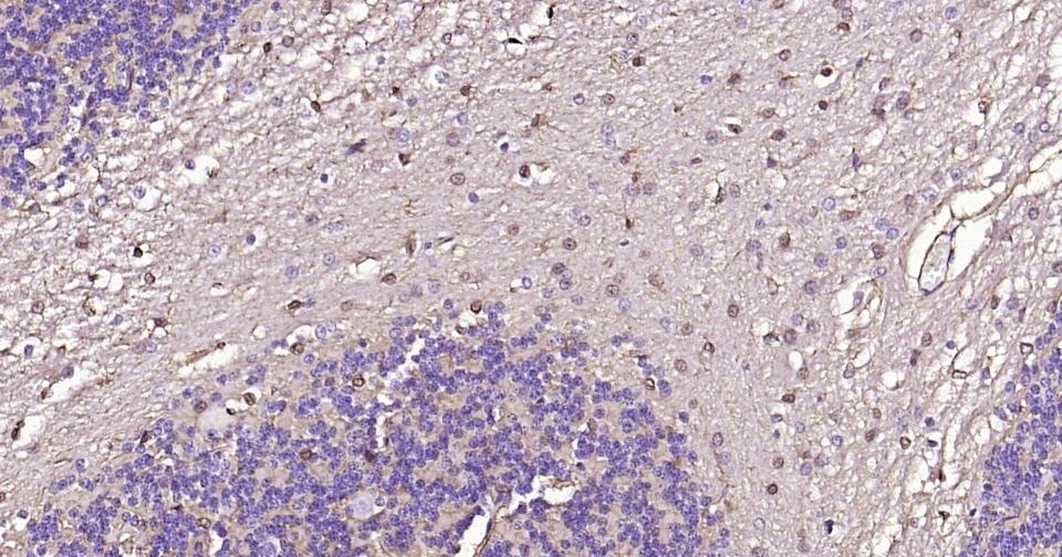 Anti-S100B Antibody (2F740)
