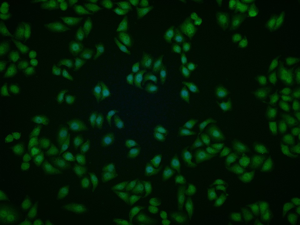 Anti-Plzf Polyclonal Antibody