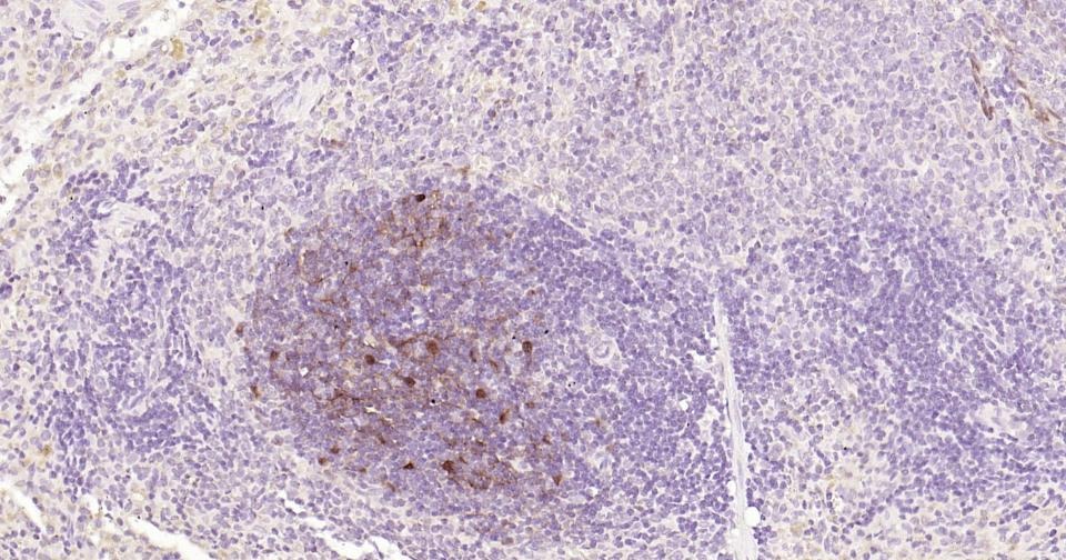 Anti-S100B Antibody (2F740)
